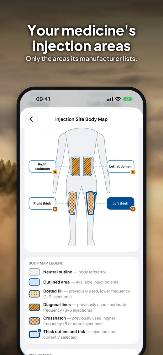 Injection areas